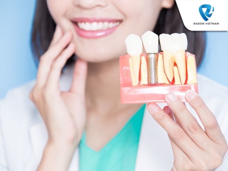 Lưu ý khi cấy ghép răng implant (Nguồn ảnh: Sưu tầm)