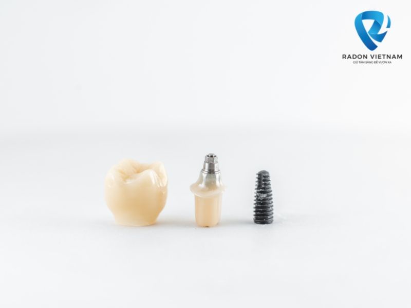 trồng răng implant