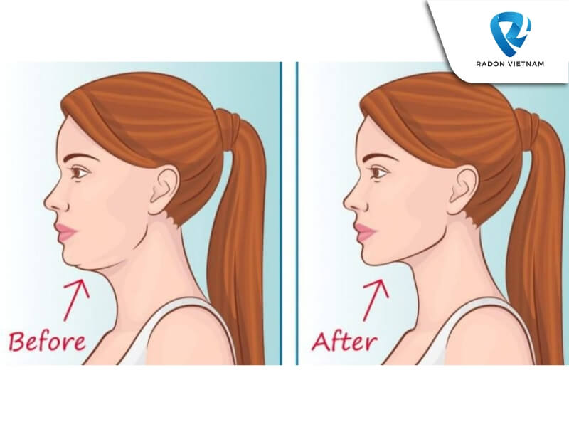 Các bài tập bổ trợ (Nguồn ảnh: Sưu tầm)