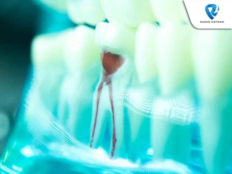 Bọc răng sứ giúp gia tăng thẩm mỹ, bảo vệ răng thật và ngừa sâu răng hiệu quả (Nguồn ảnh: Sưu tầm)