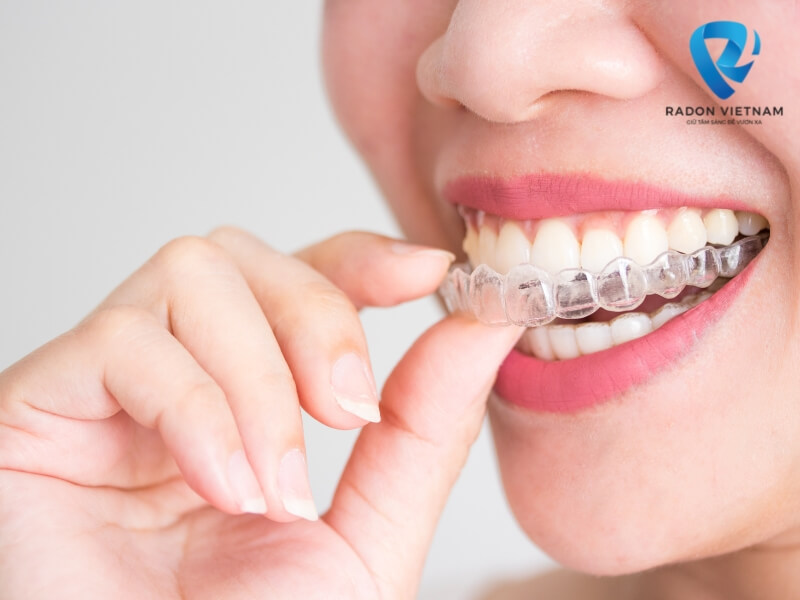Khi sử dụng niềng invisalign, bạn sẽ cảm thấy thoải mái và dễ chịu hơn (Nguồn ảnh: Sưu tầm)