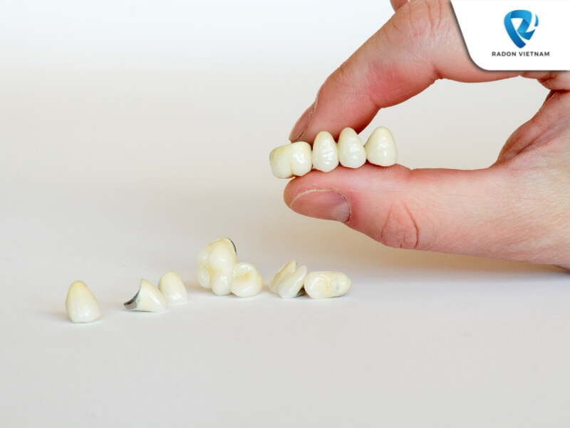 Một số điều cần lưu ý khi bọc răng sứ cần lấy tủy (Nguồn ảnh: Sưu tầm)
