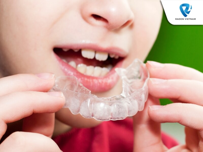 Khay Invisalign này sẽ đảm bảo tính thẩm mỹ, không gây khó chịu và tổn thương trong quá trình niềng răng (Nguồn ảnh: Sưu tầm)
