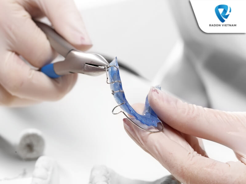 Năm 1819, biến thể đầu tiên của mắc cài hiện đại đã được tạo ra bởi Christophe-Francois Delabarre (Nguồn ảnh: Sưu tầm)