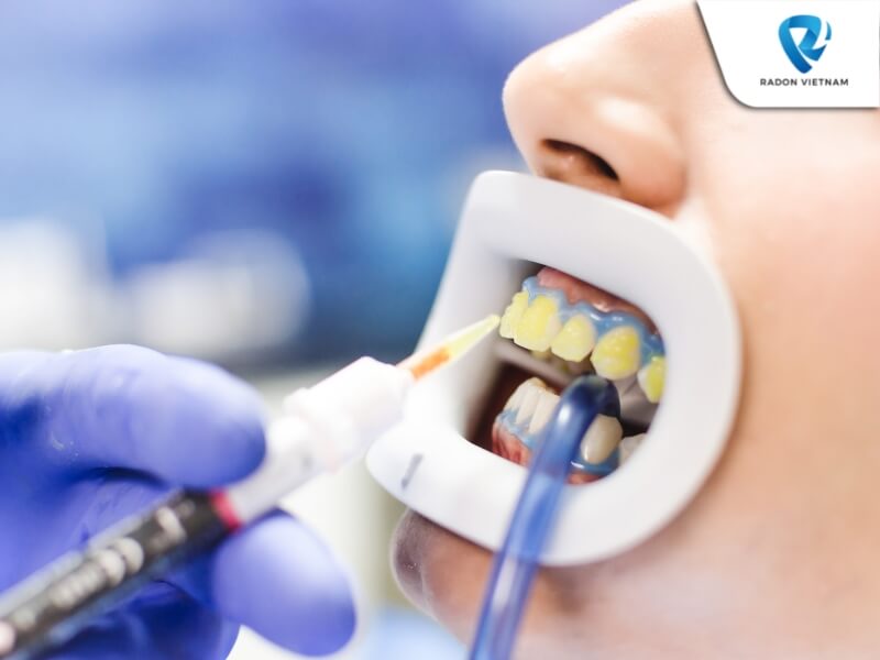 Quy trình điều trị tại các nha khoa thường qua 5 bước (Nguồn ảnh: Sưu tầm)