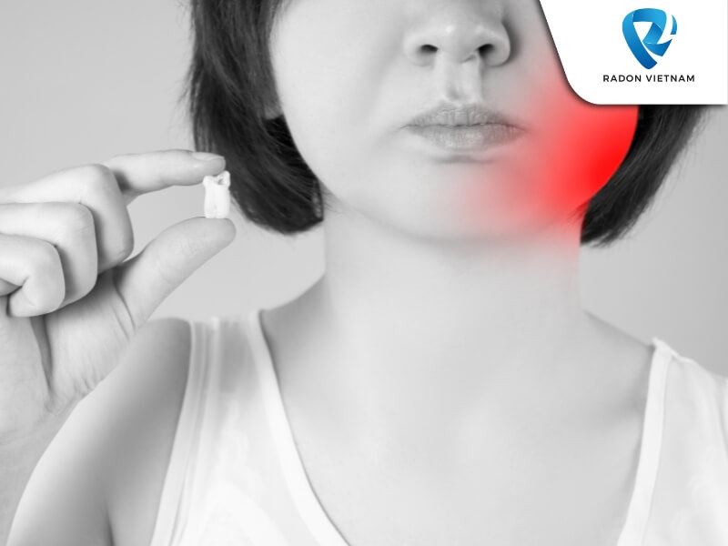 Các dấu hiệu nhận biết răng khôn mọc lệch bao gồm đau nhức; sưng lợi; đau họng; sốt nhẹ (Nguồn ảnh: Sưu tầm)