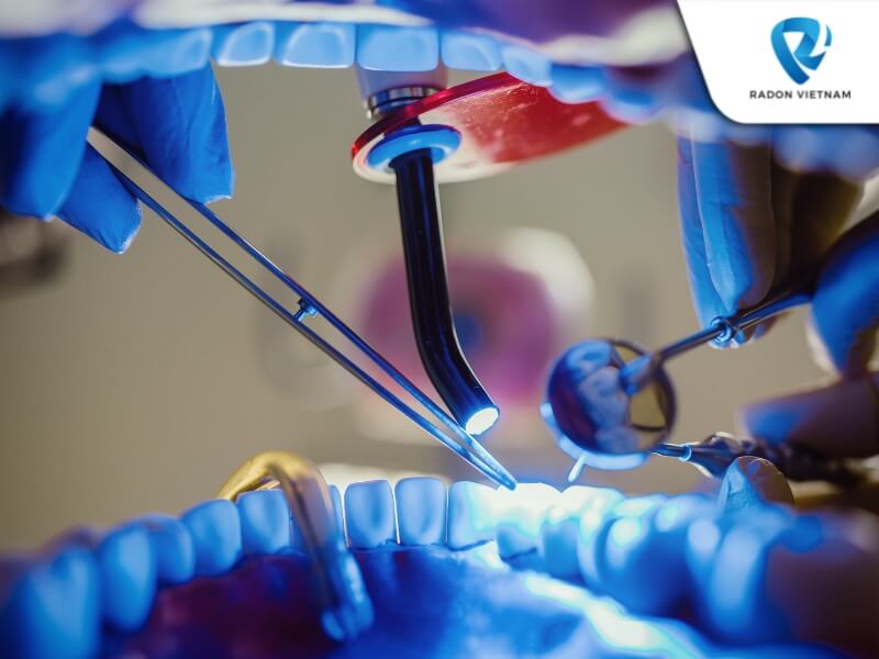 Đèn trám có thể phục hình cho răng trở nên chắc khỏe (Nguồn ảnh: Sưu tầm)