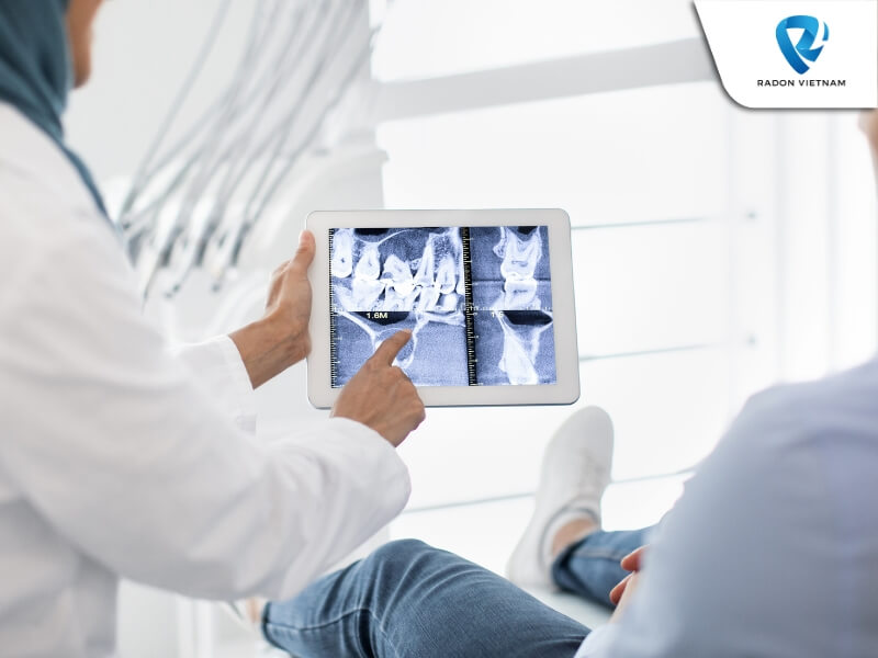 Phần mềm giúp nha sĩ dễ dàng định vị và thiết kế trụ Implant phù hợp với bệnh nhân (Nguồn ảnh: Sưu tầm)