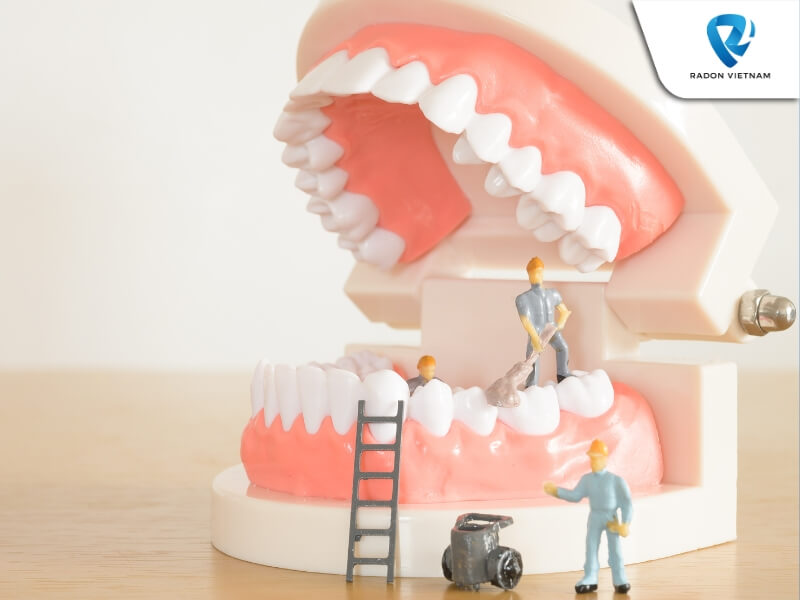 Bạn cần chăm sóc răng implant đúng cách nhằm không gây ra các biến chứng (Nguồn ảnh: Sưu tầm)