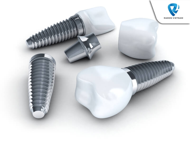 Đối với các tình trạng đau và sưng sau khi phẫu thuật cấy ghép implant, bạn nên dùng thuốc giảm đau hoặc thuốc kháng sinh (Nguồn ảnh: Sưu tầm)