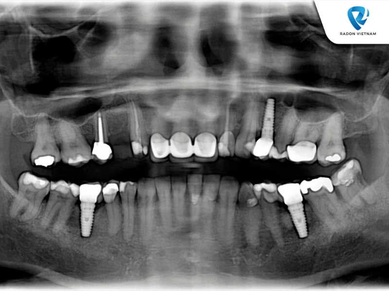 Chiếc máy này sẽ hỗ trợ nha sĩ trong các quá trình điều trị nha khoa phức tạp (Nguồn ảnh: Sưu tầm)
