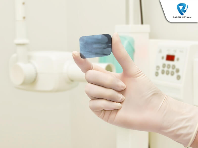 Máy chụp x-quang nha khoa truyền thống tạo ra hình ảnh chi tiết, có chi phí thấp và cách sử dụng đơn giản (Nguồn ảnh: Sưu tầm)