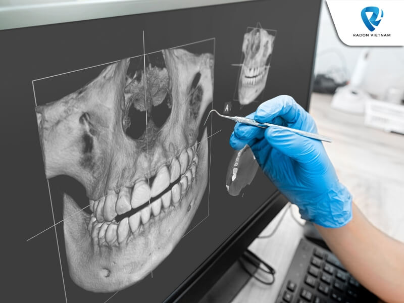 Thiết bị có thể giúp nha sĩ đánh giá và xác định các khối u, bệnh lý hay tổn thương vùng hàm. (Nguồn ảnh: Sưu tầm)