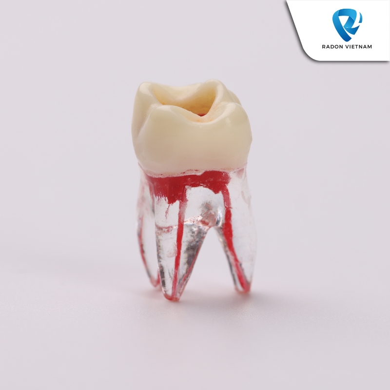 Điều trị nội nha là phương pháp điều trị các bệnh lý liên quan đến tủy răng.