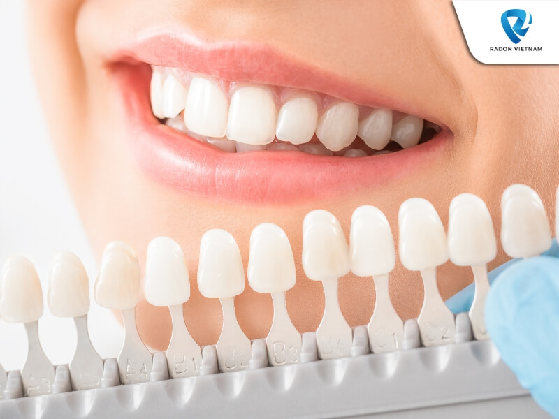 Tẩy trắng răng có hiệu quả cao và giúp răng trắng sáng lên từ 2 đến 8 tông màu (Nguồn ảnh: Sưu tầm)