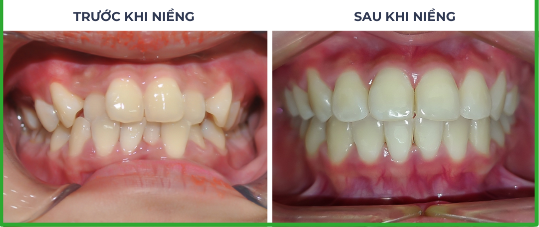 Cung cấp hình ảnh thực tế thàn công trước - sau để tăng uy tín