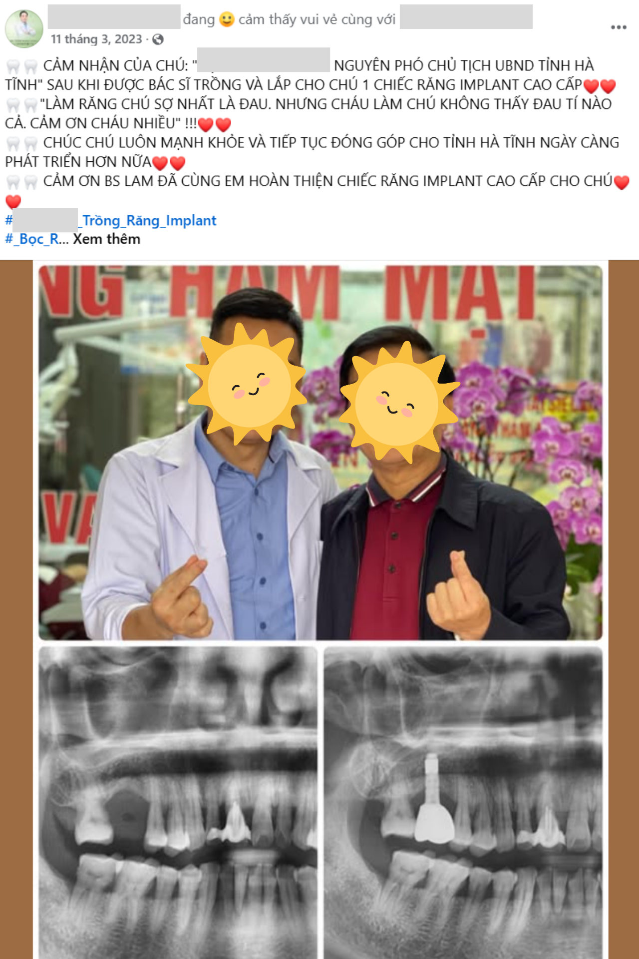 Hình minh họa: Bài viết của một nha sĩ về ca trồng răng Implant thành công