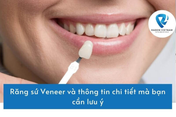 Răng sứ Veneer và thông tin chi tiết mà bạn cần lưu ý