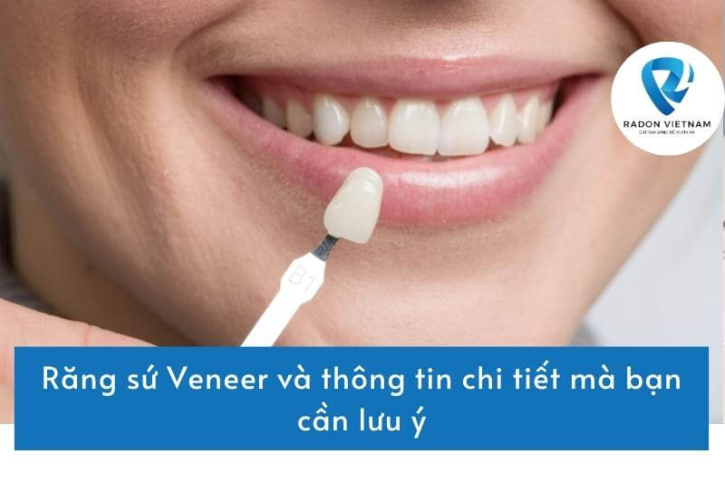 Răng sứ Veneer và thông tin chi tiết mà bạn cần lưu ý