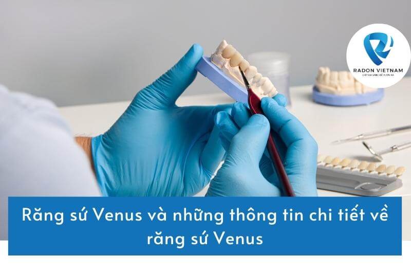 Răng sứ Venus và những thông tin chi tiết về răng sứ Venus