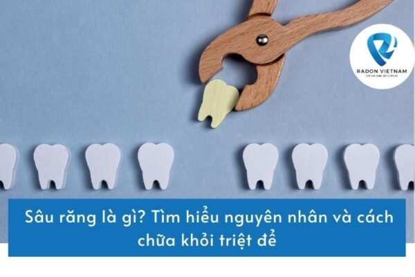Sâu răng là gì? Tìm hiểu nguyên nhân và cách chữa khỏi triệt để