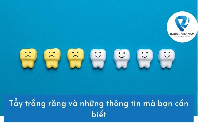 Tẩy trắng răng và những thông tin mà bạn cần biết