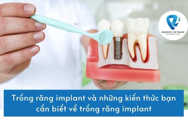 Trồng răng implant và những kiến thức bạn cần biết về trồng răng implant