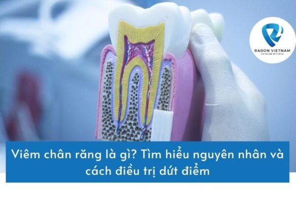 Viêm chân răng là gì? Tìm hiểu nguyên nhân và cách điều trị dứt điểm