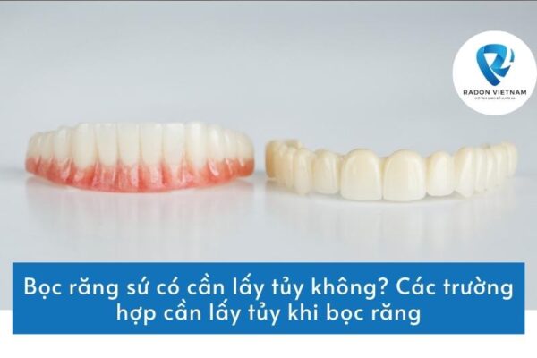 Bọc răng sứ có cần lấy tủy không? Các trường hợp cần lấy tủy khi bọc răng