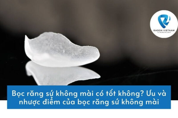 Bọc răng sứ không mài có tốt không? Ưu và nhược điểm của bọc răng sứ không mài