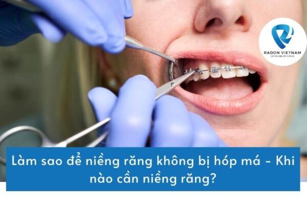 Làm sao để niềng răng không bị hóp má - Khi nào cần niềng răng?