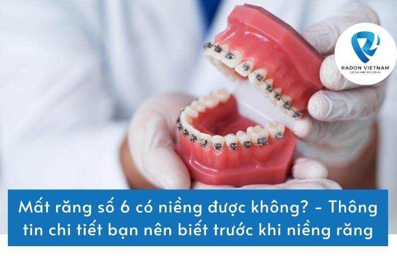 Mất răng số 6 có niềng được không? - Thông tin chi tiết bạn nên biết trước khi niềng răng