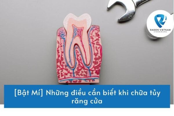 [Bật Mí] Những điều cần biết khi chữa tủy răng cửa