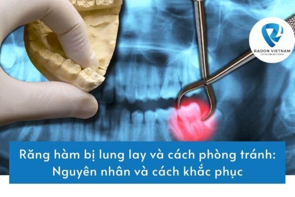 Răng hàm bị lung lay và cách phòng tránh: Nguyên nhân và cách khắc phục