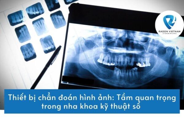 Thiết bị chẩn đoán hình ảnh: Tầm quan trọng trong nha khoa kỹ thuật số