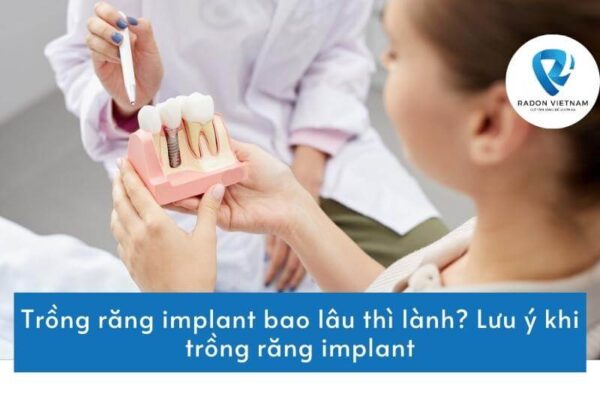 Trồng răng implant bao lâu thì lành? Lưu ý khi trồng răng implant