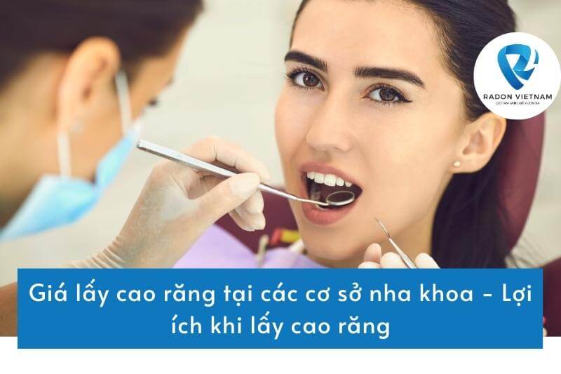 Giá lấy cao răng tại các cơ sở nha khoa - Lợi ích khi lấy cao răng