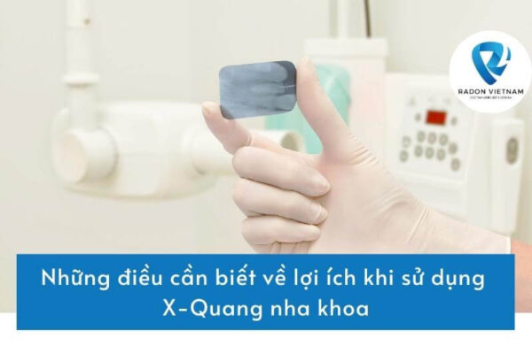 Những điều cần biết về lợi ích khi sử dụng X-quang nha khoa