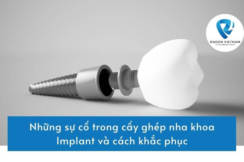 Những sự cố trong cấy ghép nha khoa Implant và cách khắc phục