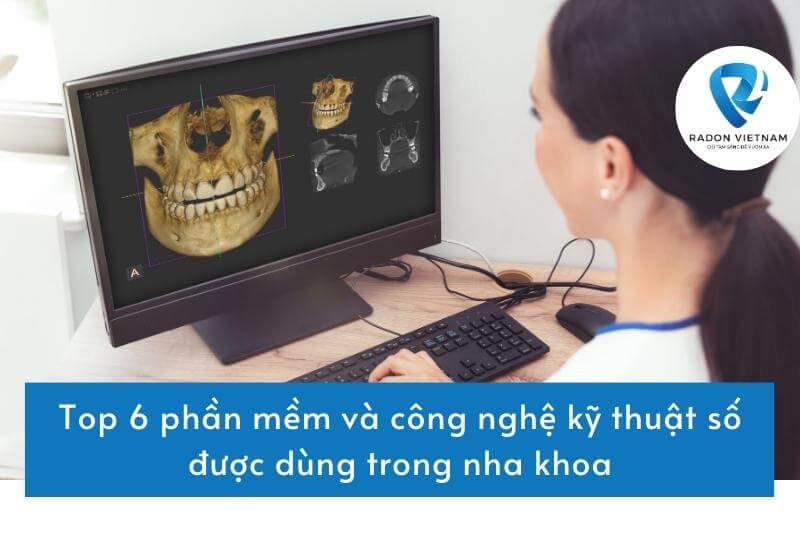 Top 6 phần mềm và công nghệ kỹ thuật số được dùng trong nha khoa