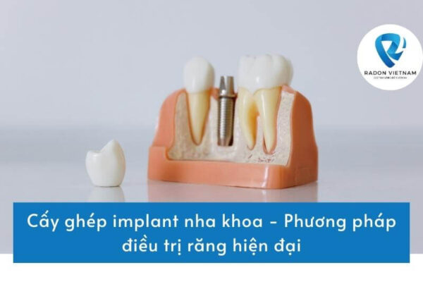 Cấy ghép implant nha khoa - Phương pháp điều trị răng hiện đại