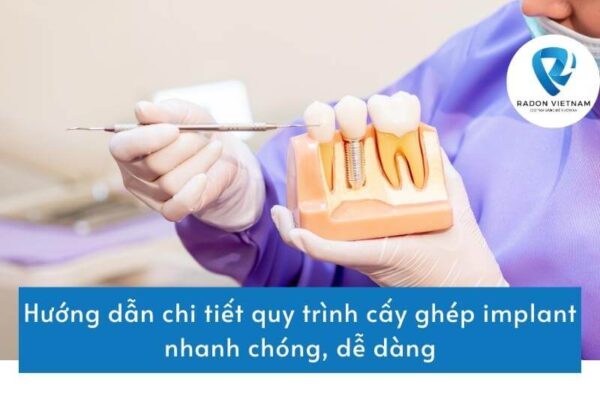 Hướng dẫn chi tiết quy trình cấy ghép implant nhanh chóng, dễ dàng