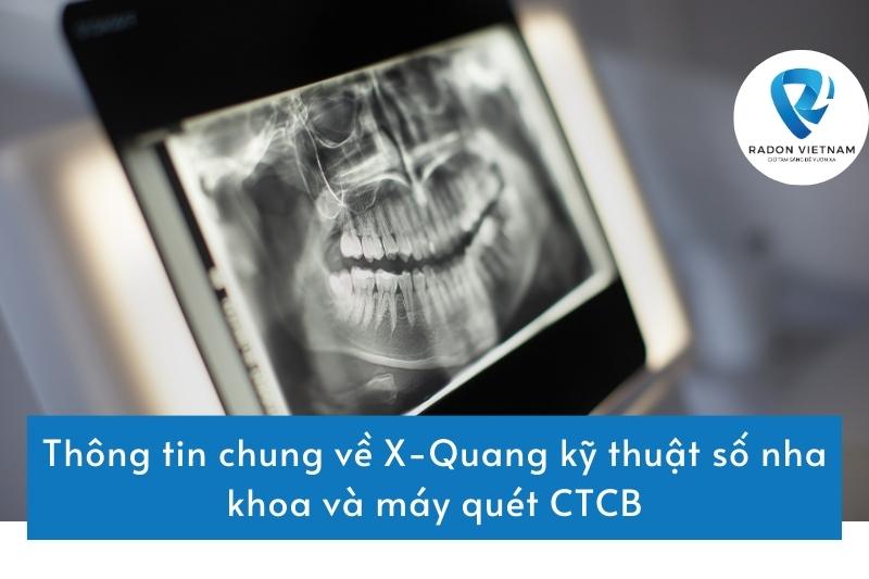Thông tin chung về X-Quang kỹ thuật số nha khoa và máy quét CTCB