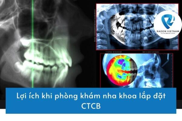 Lợi ích khi phòng khám nha khoa lắp đặt CTCB
