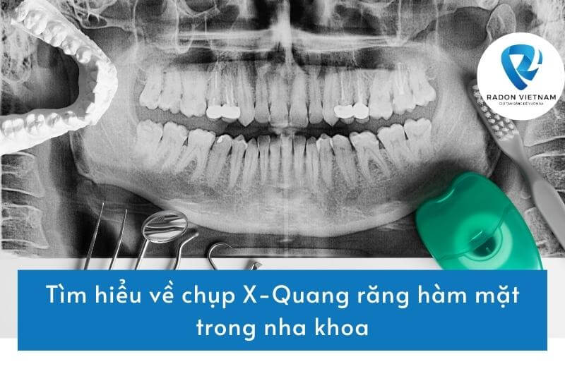 Tìm hiểu về chụp X-Quang răng hàm mặt trong nha khoa
