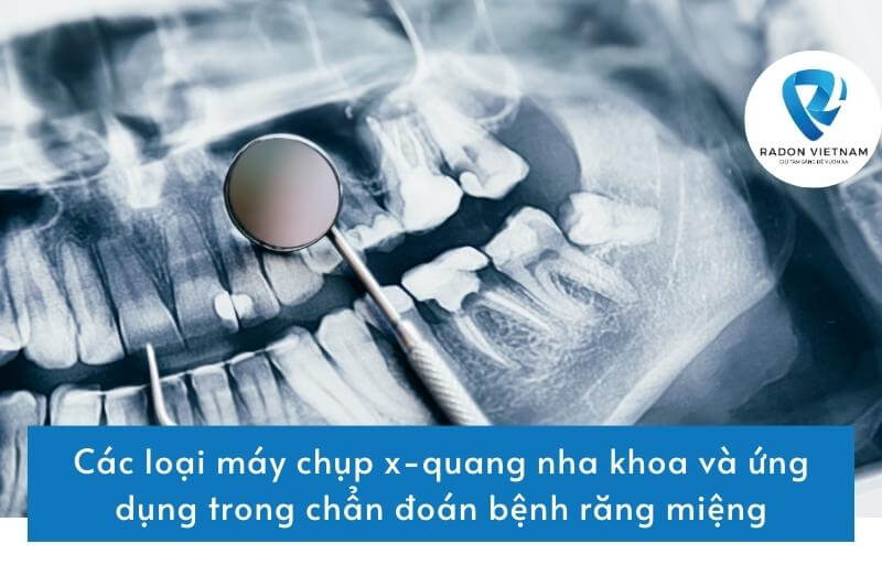 Các loại máy chụp x-quang nha khoa và ứng dụng trong chẩn đoán bệnh răng miệng
