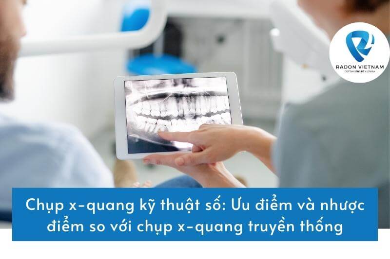 Chụp x-quang kỹ thuật số: Ưu điểm và nhược điểm so với chụp x-quang truyền thống