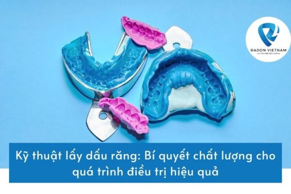 Kỹ thuật lấy dấu răng: Bí quyết chất lượng cho quá trình điều trị hiệu quả