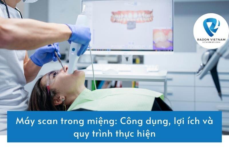 Máy scan trong miệng: Công dụng, lợi ích và quy trình thực hiện