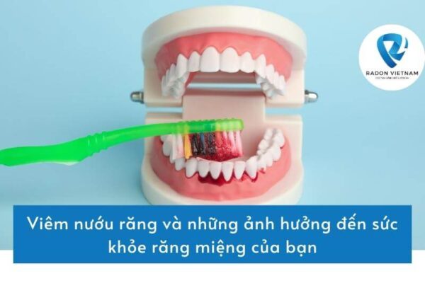 Viêm nướu răng và những ảnh hưởng đến sức khỏe răng miệng của bạn